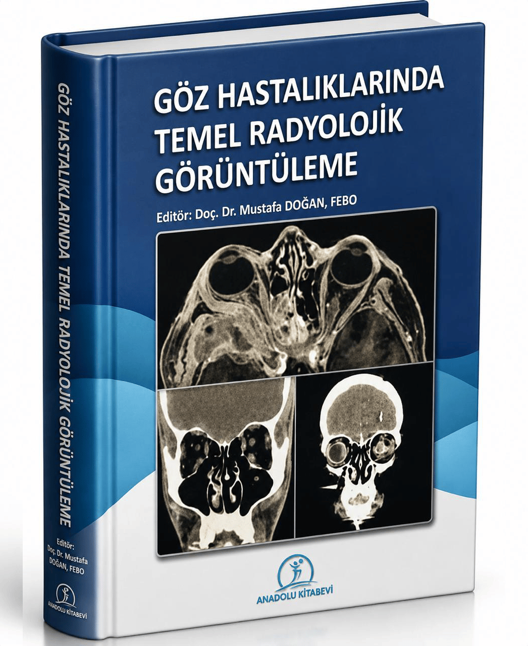 Göz Hastalıklarında Temel Radyolojik Görüntüleme