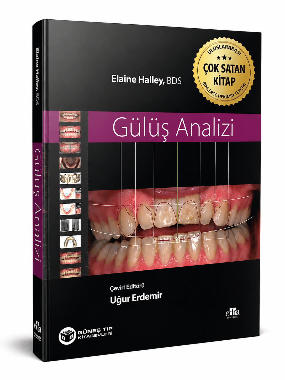 Gülüş Analizi