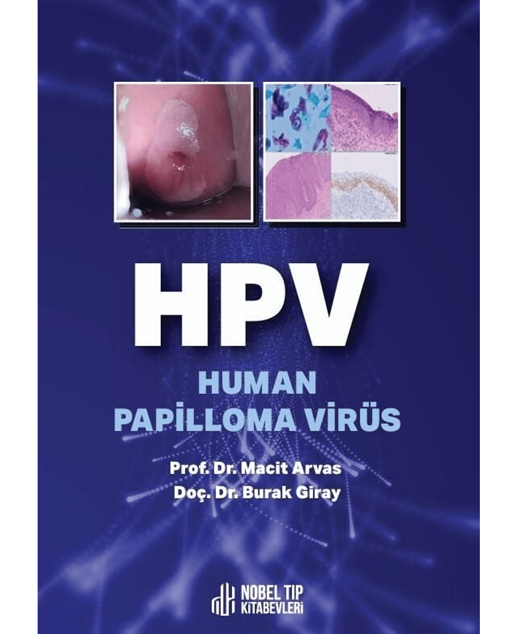 HPV - Human Papilloma Virus