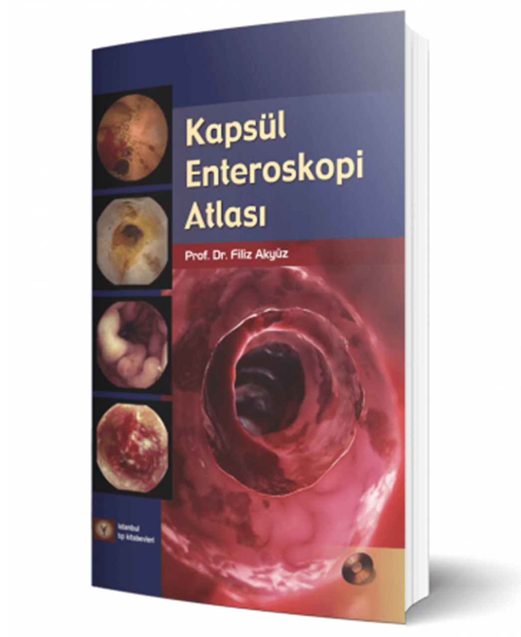 Kapsül Enteroskopi Atlası