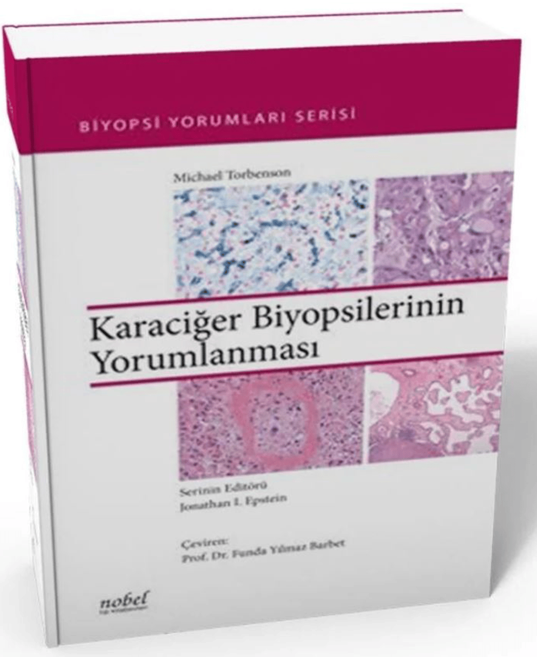 Karaciğer Biyopsilerinin Yorumlanması Biyopsi Yorumları Serisi