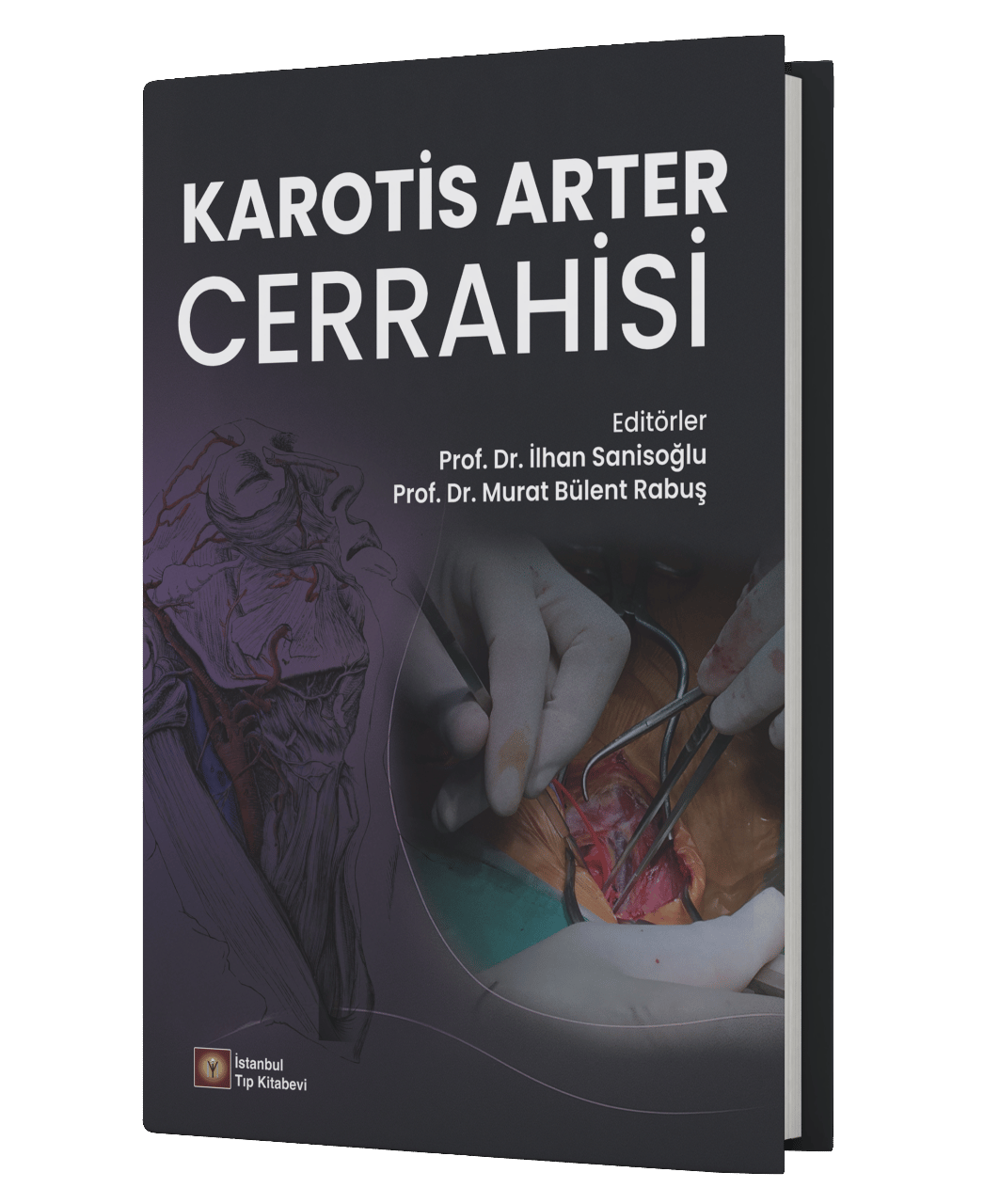 Karotis Arter Cerrahisi