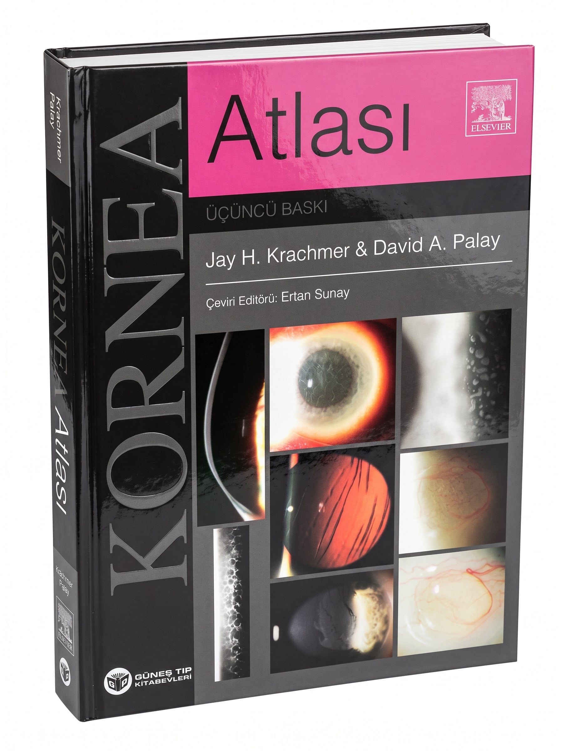 Krachmer Kornea Atlası