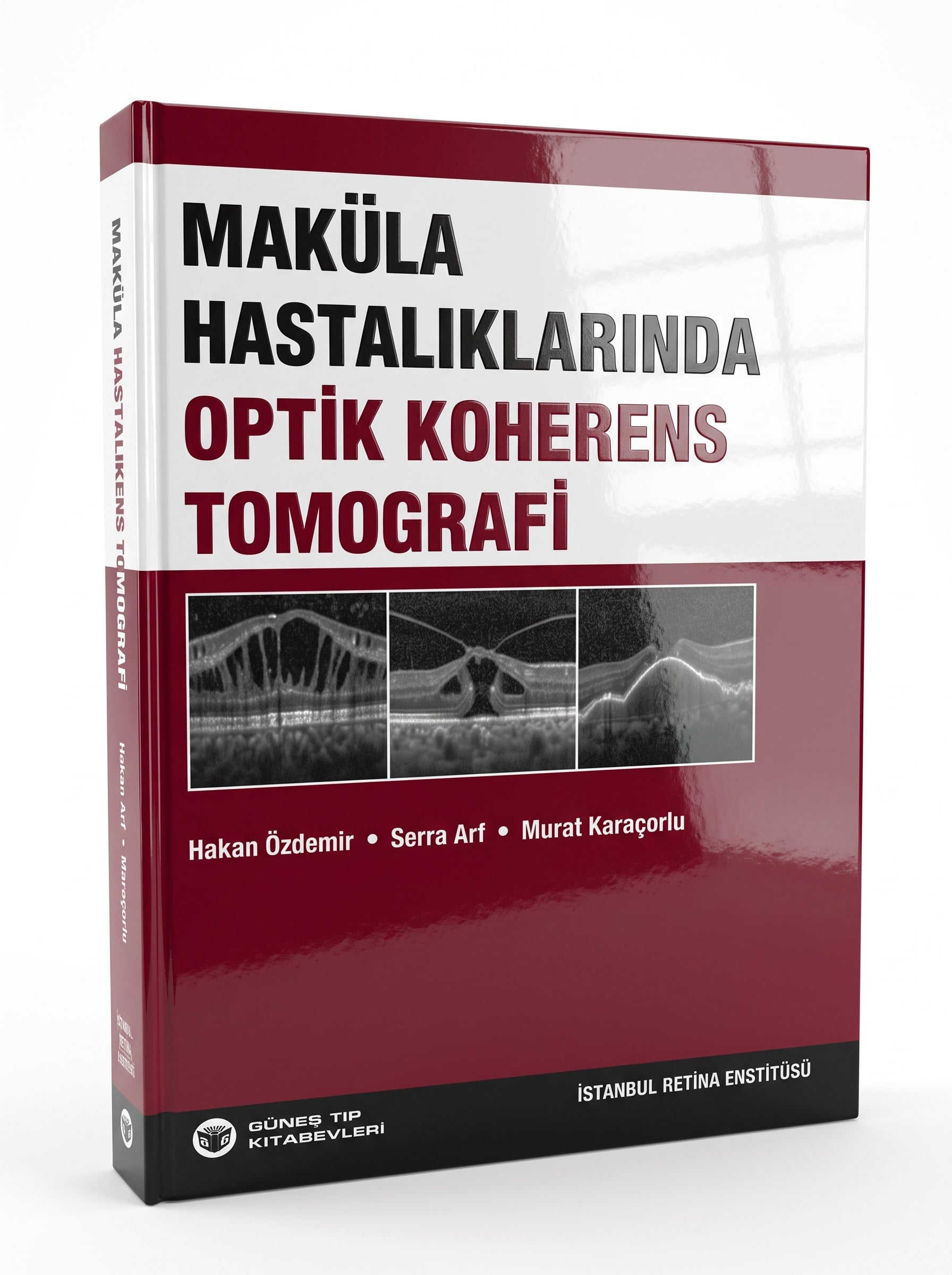 Maküla Hastalıklarında Optik Koherens Tomografi
