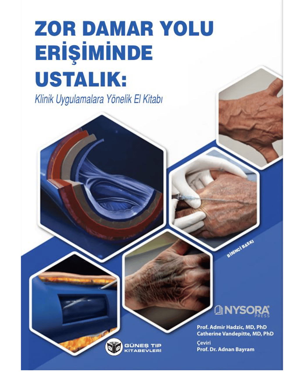 NYSORA - Zor Damar Yolu Erişiminde Ustalık: Klinik Uygulamalara Yönelik El Kitabı