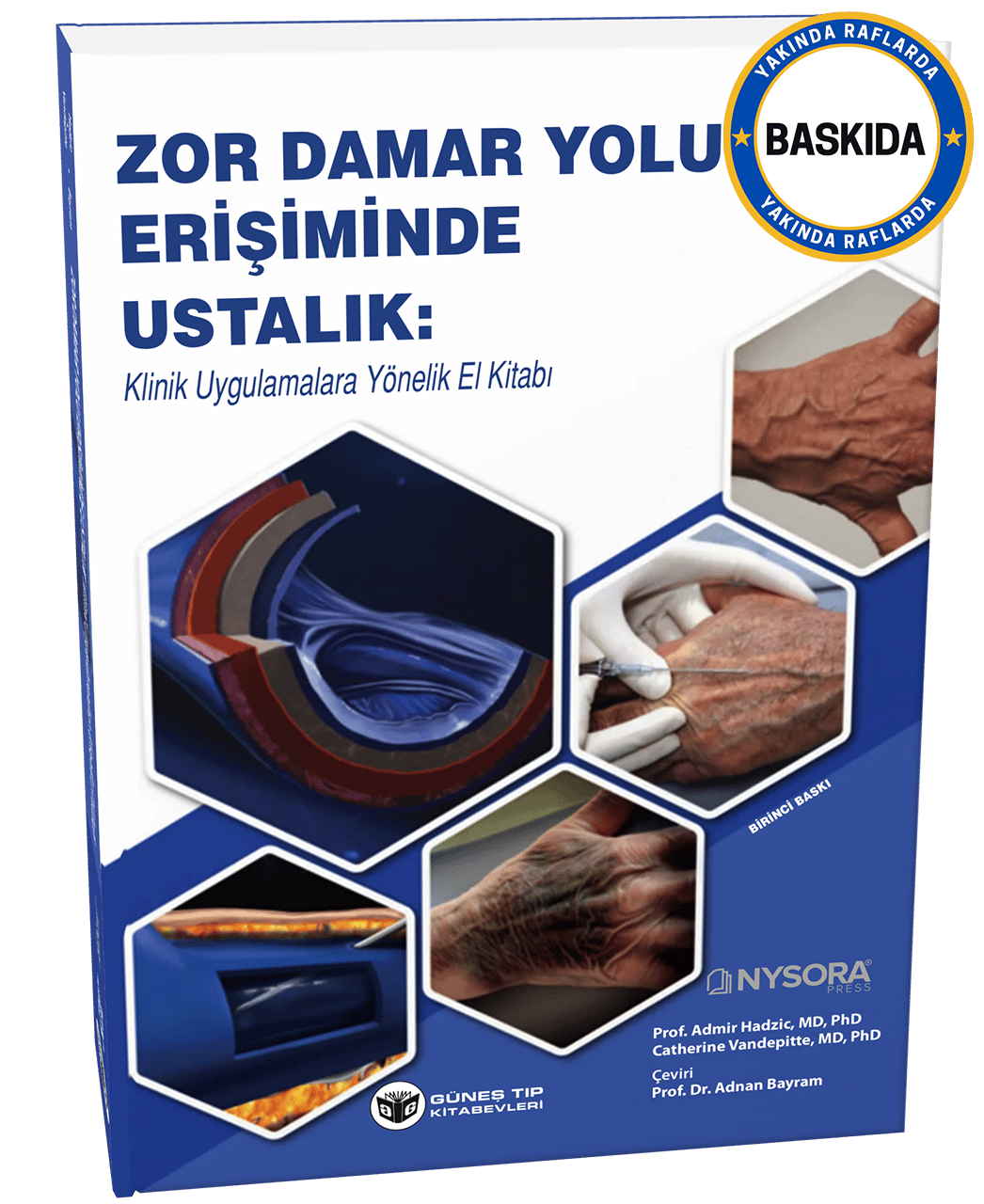 NYSORA - Zor Damar Yolu Erişiminde Ustalık: Klinik Uygulamalara Yönelik El Kitabı