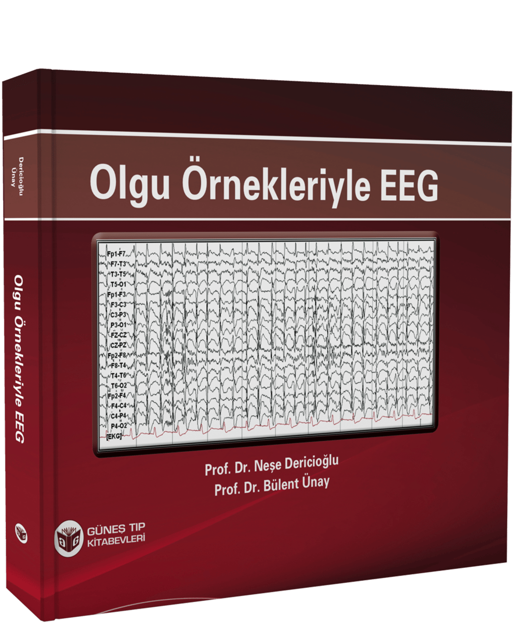 Olgu Örnekleriyle EEG