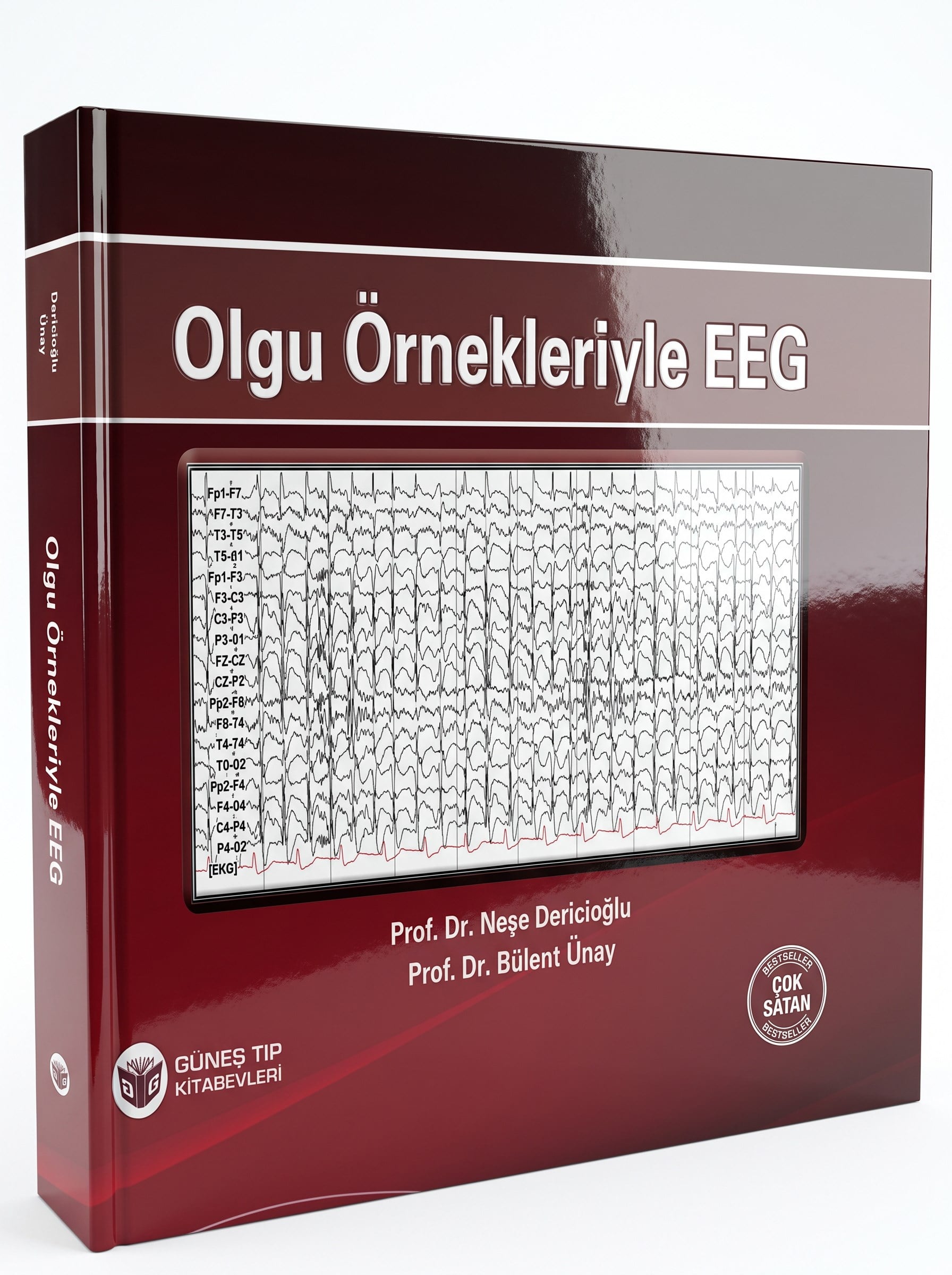 Olgu Örnekleriyle EEG