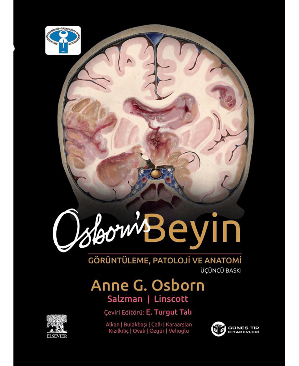 Osborn's Beyin Görüntüleme, Patoloji ve Anatomi 3. Baskı