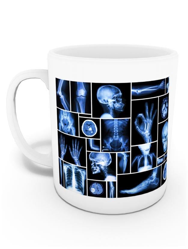 Radyoloji Tekniker Kupası (İsme Özel)