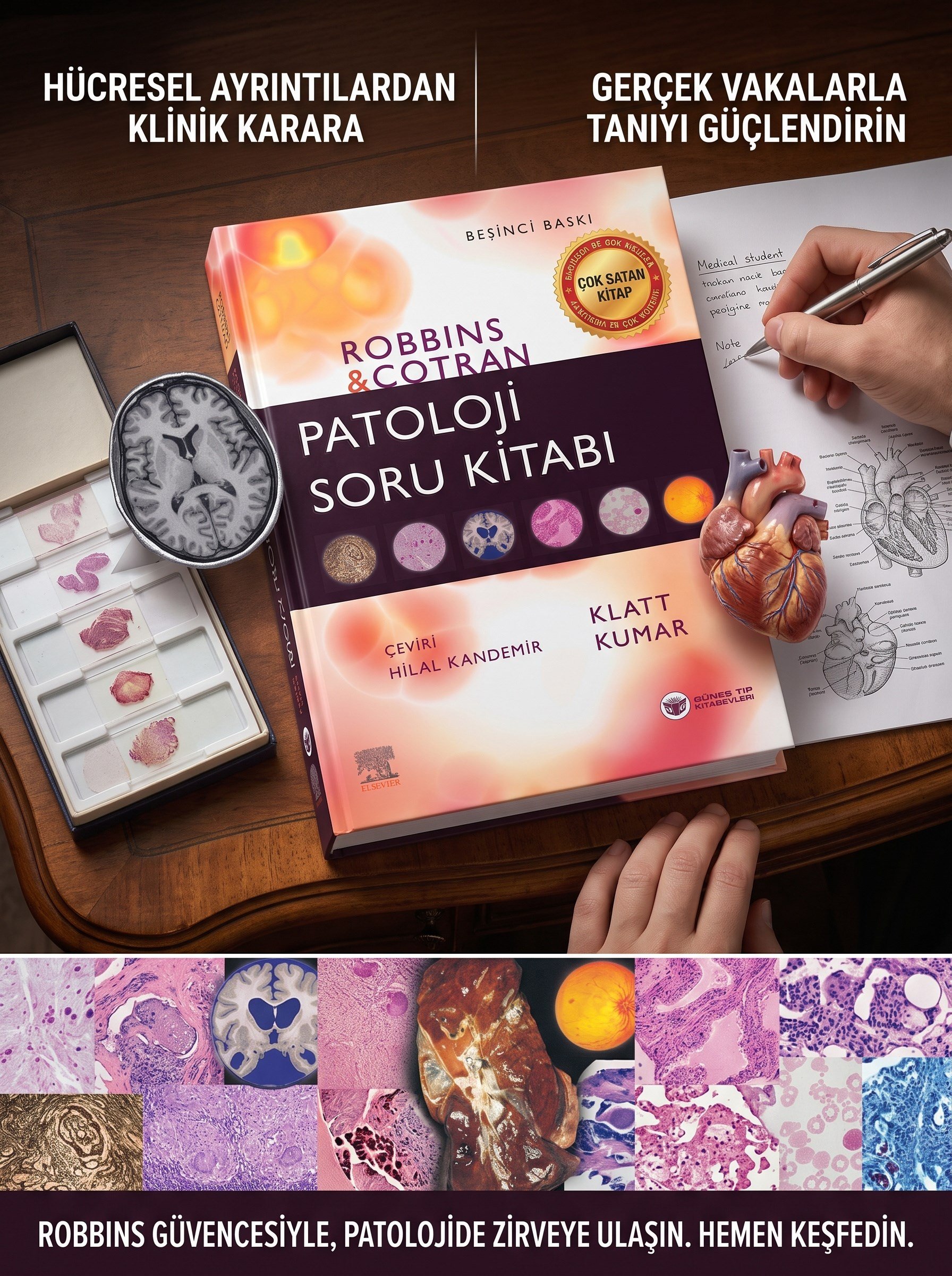 Robbins Patoloji Soru Kitabı (Kapsamlı Gözden Geçirme)