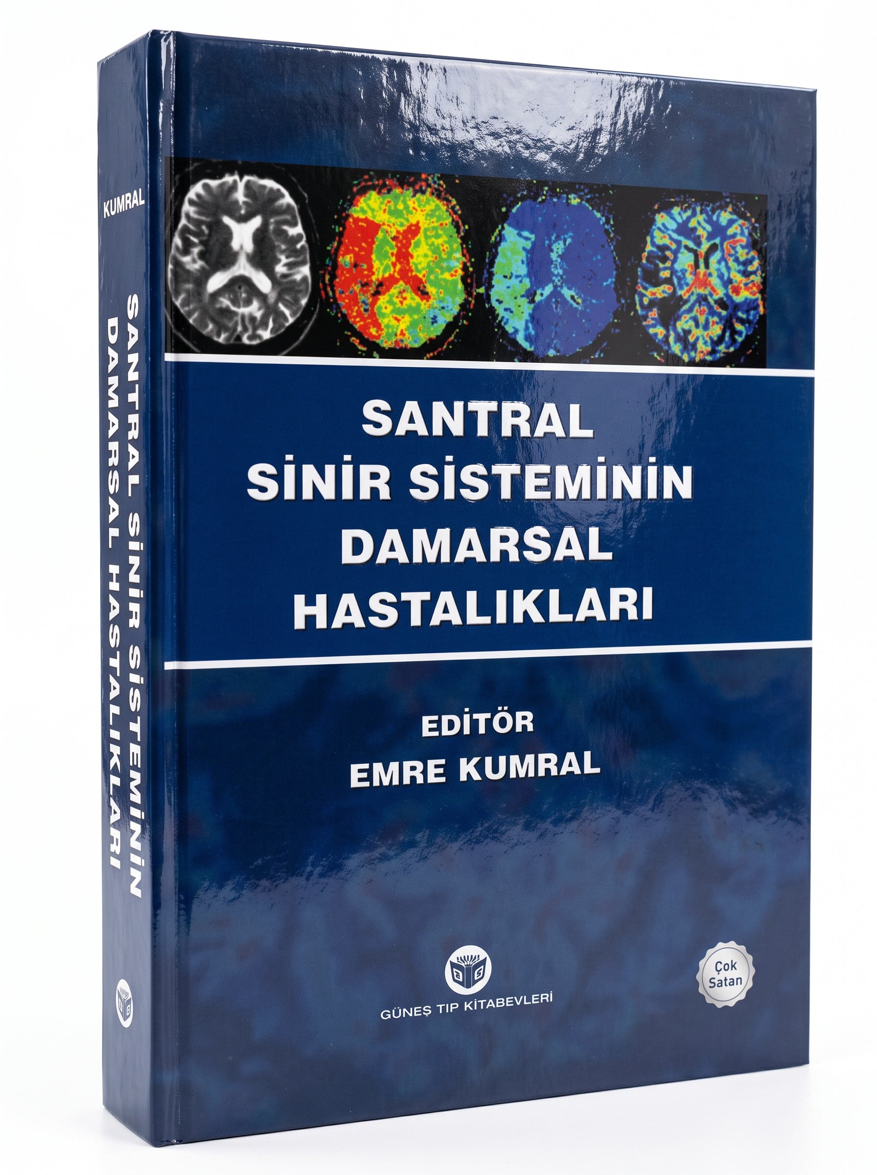 Santral Sinir Sisteminin Damarsal Hastalıkları