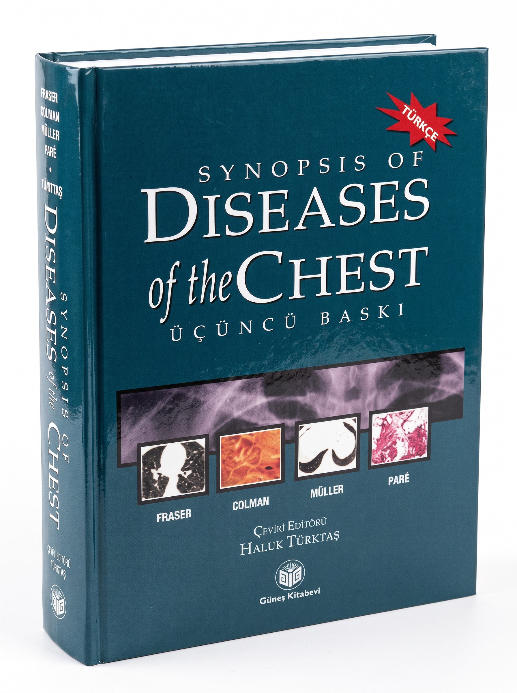 Synopsis of Diseases of The Chest (Türkçesi)