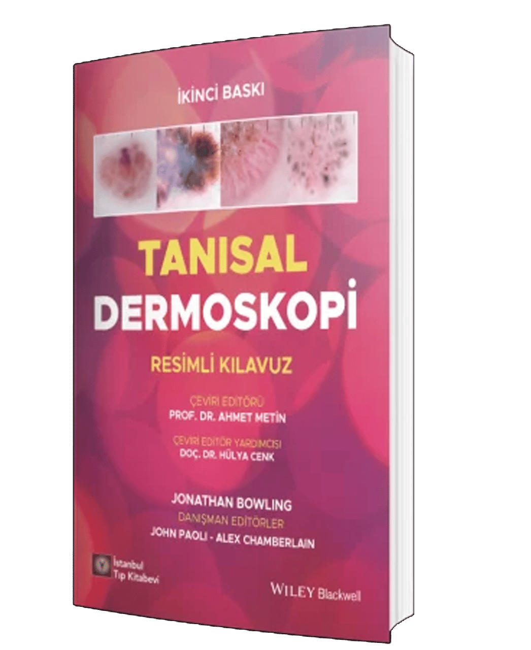 Tanısal Dermoskopi Resimli Kılavuz
