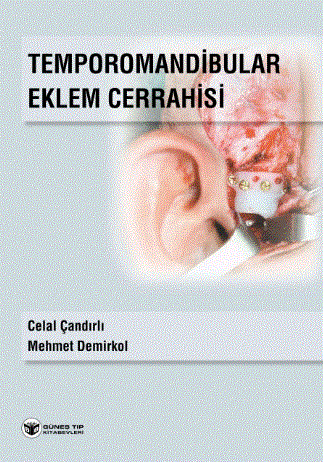 Temporomandibular Eklem Cerrahisi