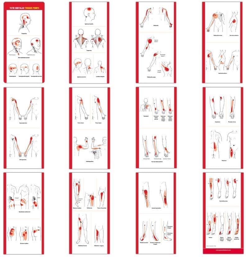 Tetik Noktalar Trigger Points