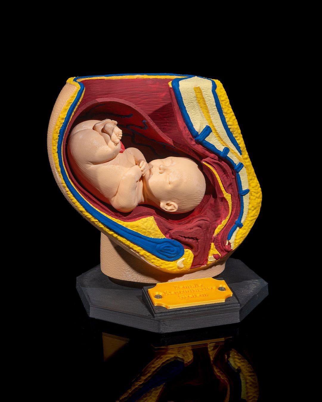 kadin-ureme-sistemi-modeli-29a-ea.jpg