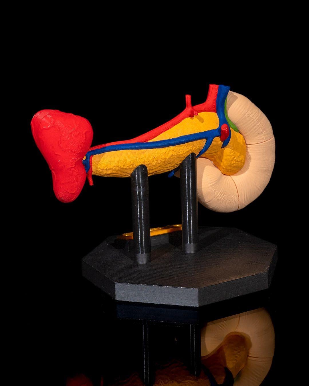 pankreas-anatomik-model-9d5d73.jpg