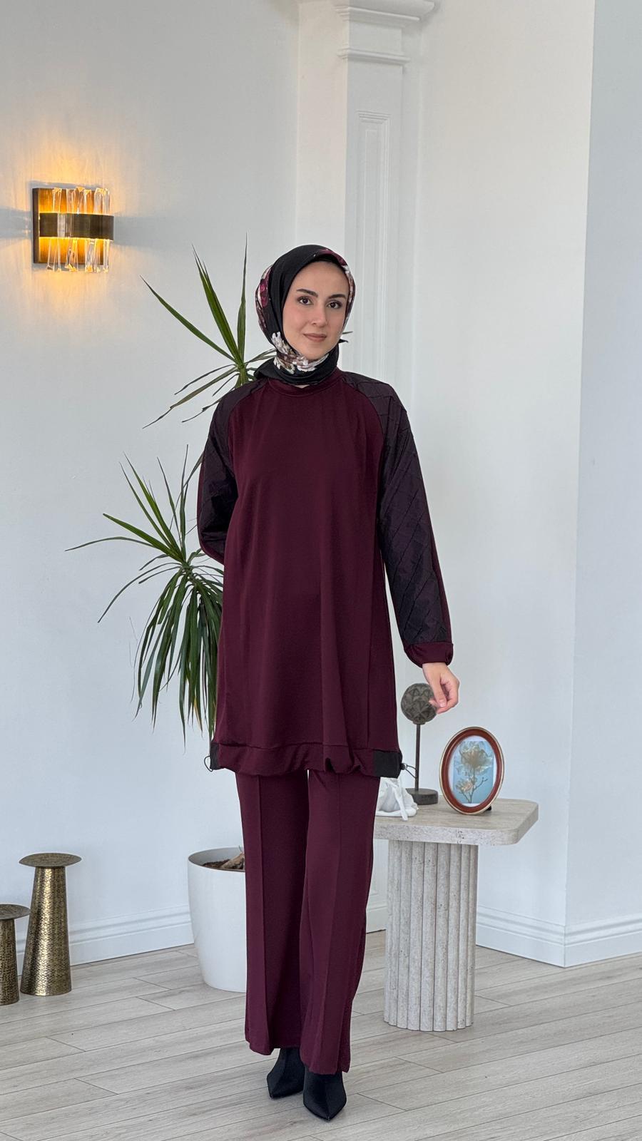 MİSSWHENCE TUNİK-38040