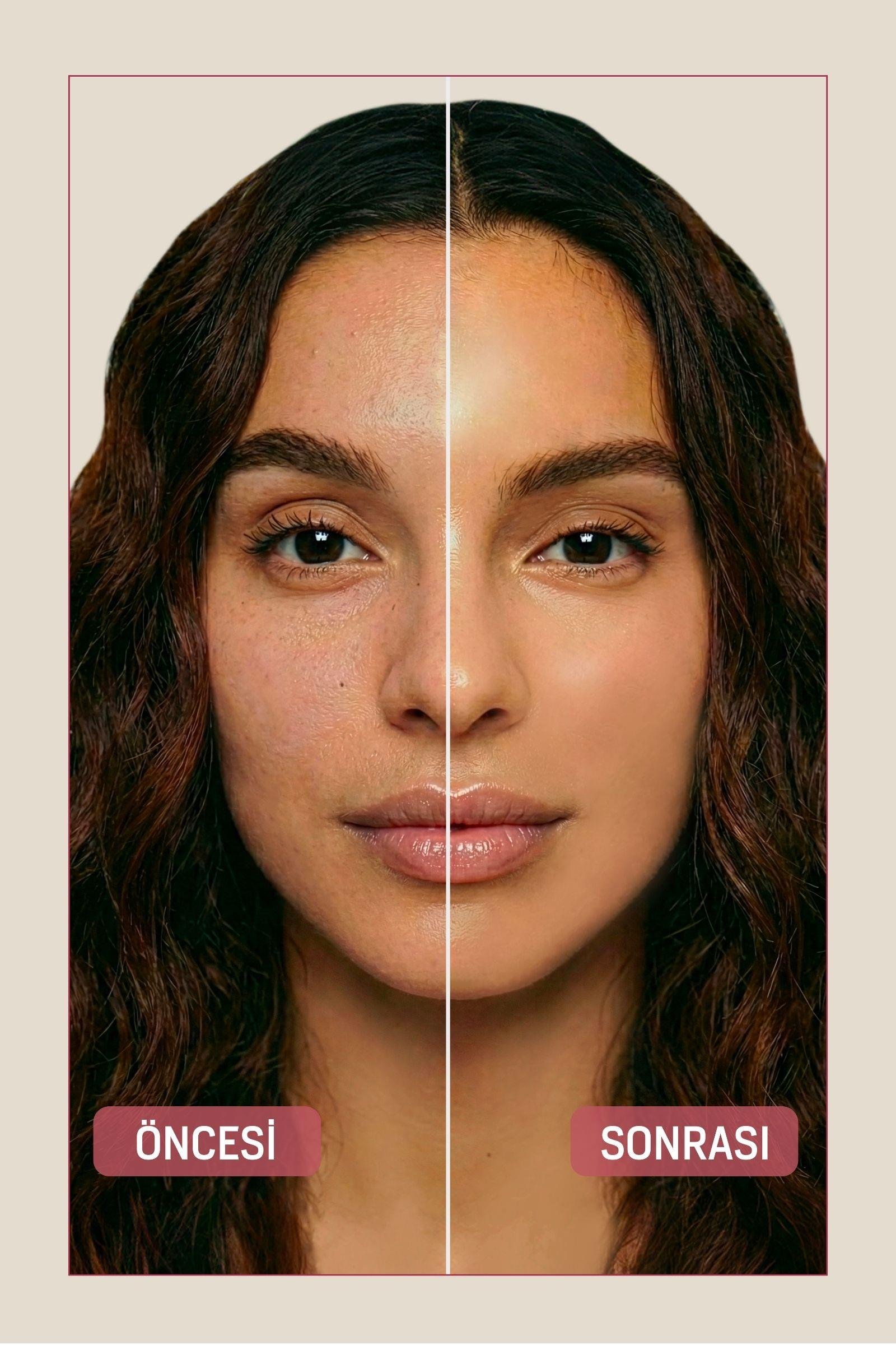 BB Krem Medium 25 Spf 40 ml Doğal Kapatıcı Etkili Leke Karşıtı Aydınlatıcı