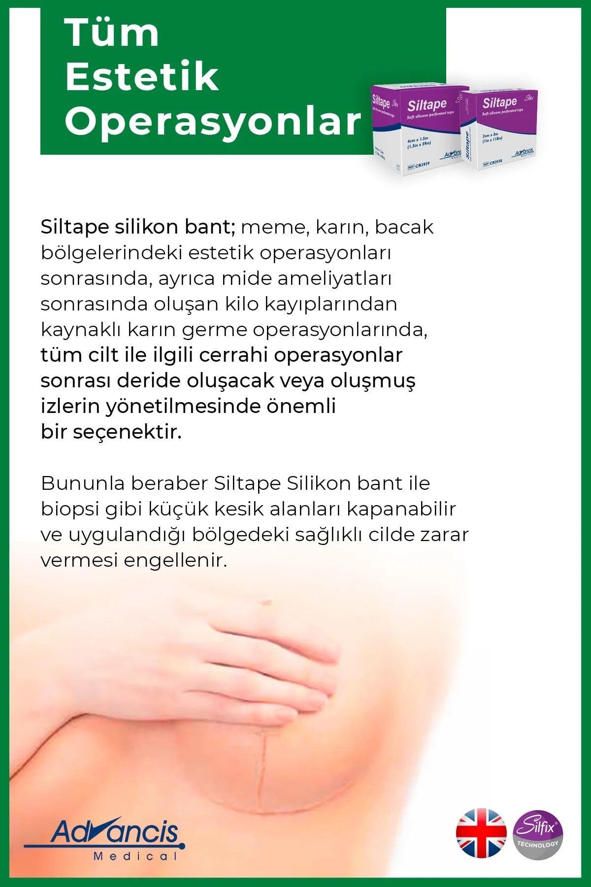 Advancis Medical UK Siltape Soft Silikon Bant Yara Izi - Dikiş Izi - Sezaryen - Yanık - Estetik 2cm X 3mt
