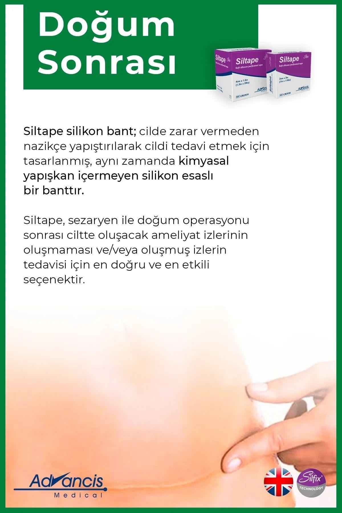 Advancis Medical UK Siltape Soft Silikon Bant Yara Izi - Dikiş Izi - Sezaryen - Yanık - Estetik 2cm X 3mt