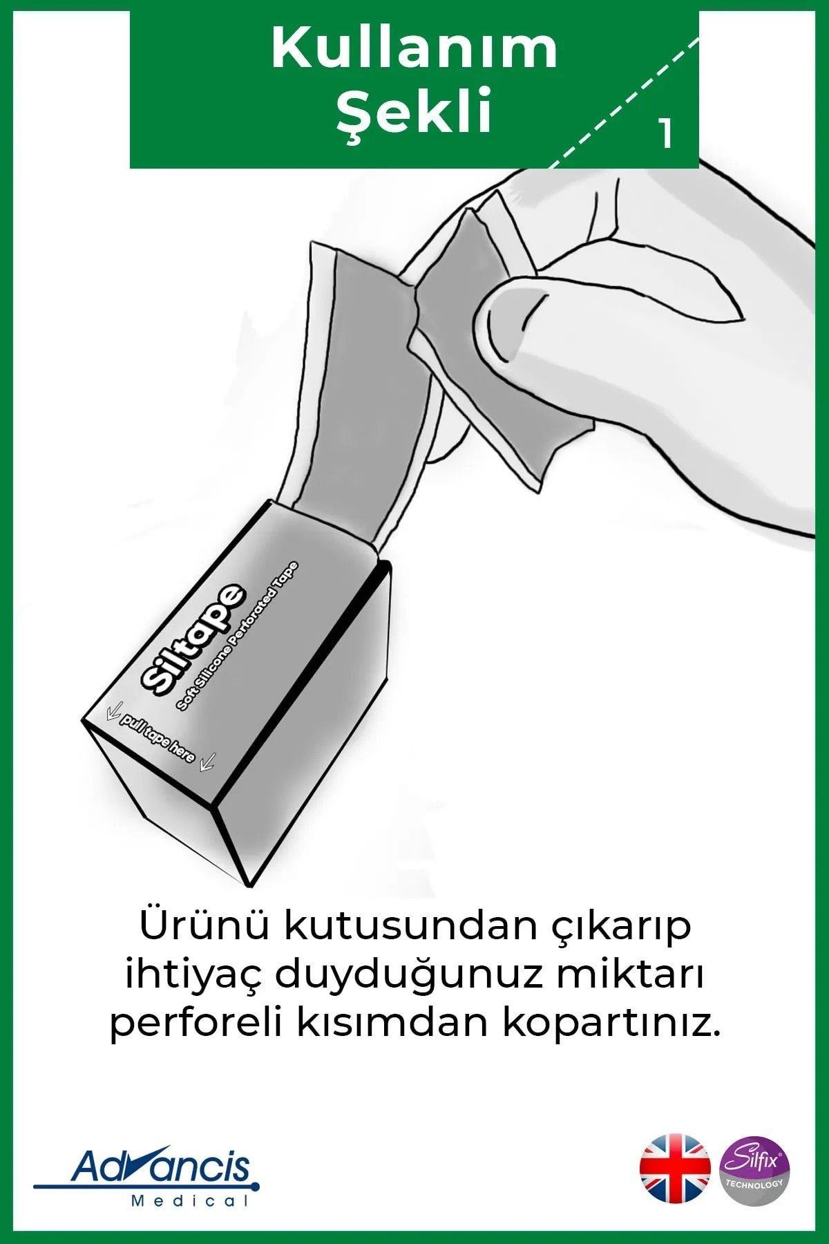 Advancis Medical UK Siltape Soft Silikon Bant Yara Izi - Dikiş Izi - Sezaryen - Yanık - Estetik 2cm X 3mt