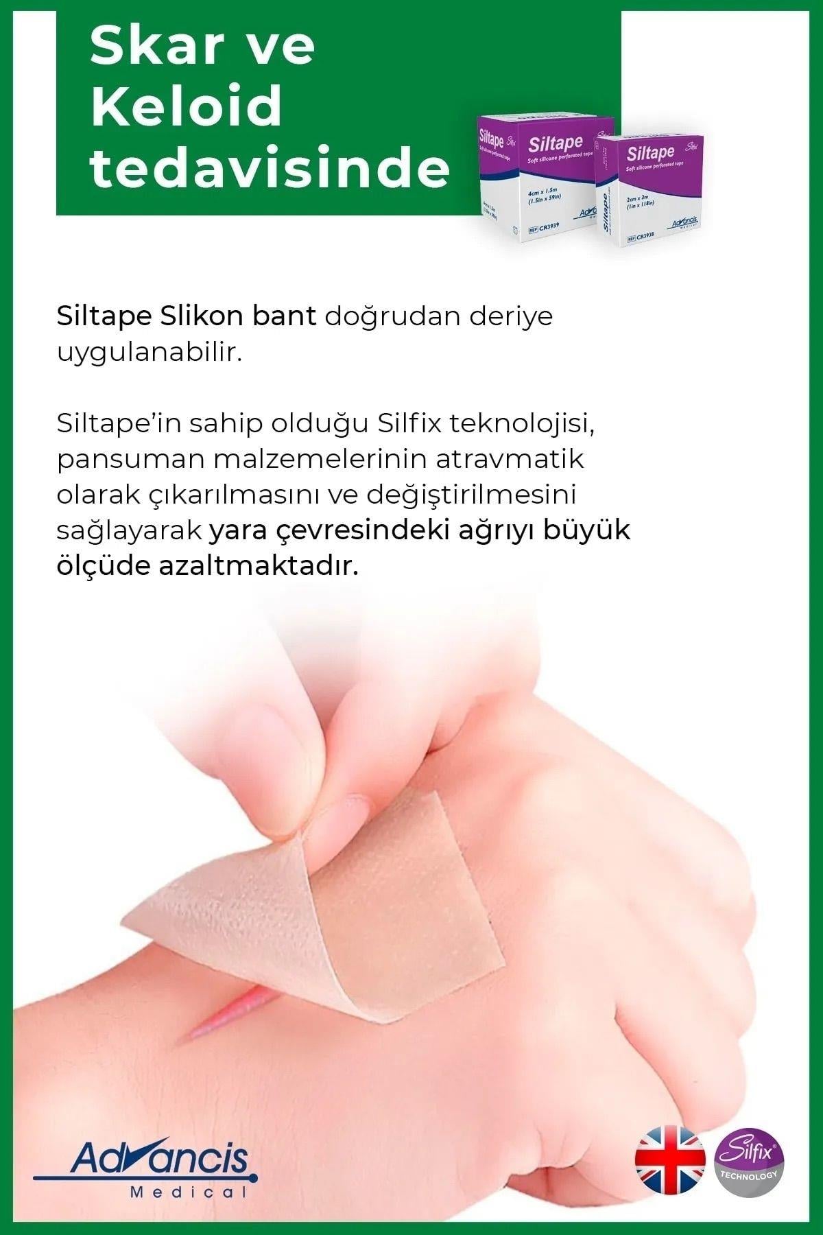 Advancis Medical UK Siltape Soft Silikon Bant Yara Izi - Dikiş Izi - Sezaryen - Yanık - Estetik 2cm X 3mt