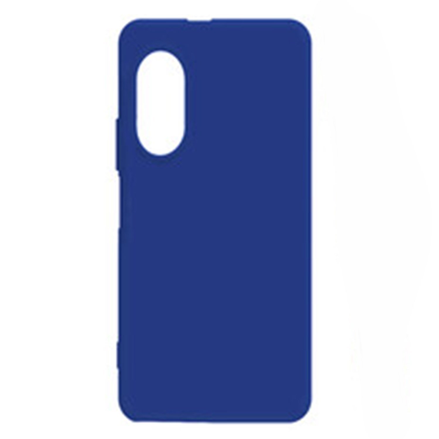 Nettech Huawei Nova 9 SE Uyumlu Trend Seri Arka Koruma Kılıf NT-97642