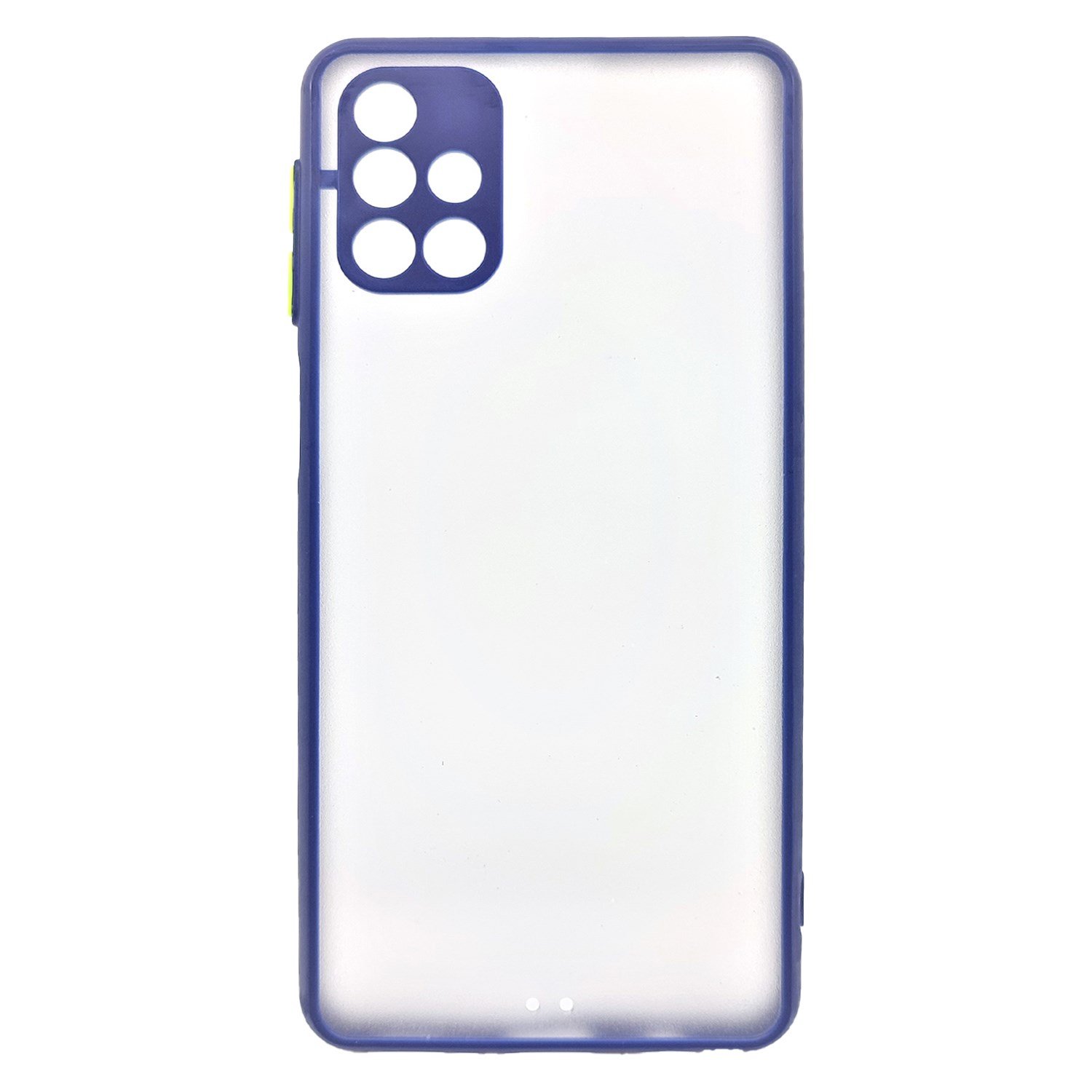 Nettech Samsung Galaxy M31S Uyumlu Kontrast Renkli Tuş Seri Arka Koruma Kılıf NT-88752
