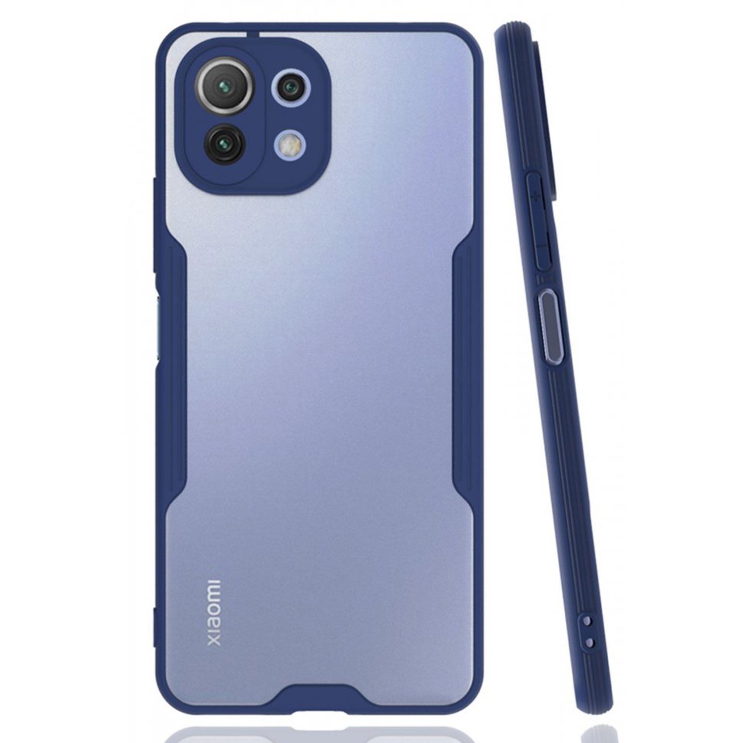 Nettech Xiaomi Mi 11 Lite Uyumlu Platin Seri Arka Koruma Kılıf NT-86524