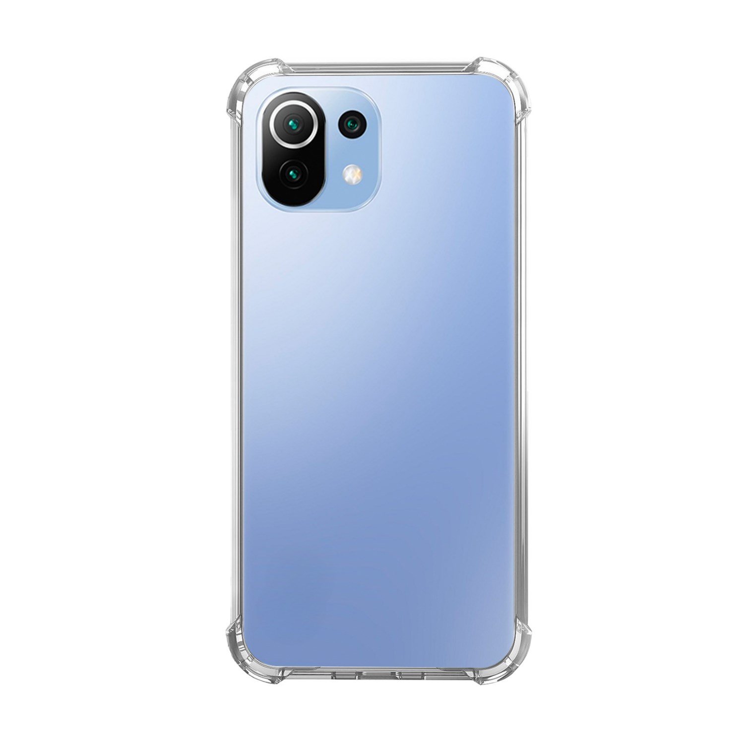 Nettech Xiaomi Mi 11 Lite Uyumlu Rarroz Seri Arka Koruma Kılıf NT-88085
