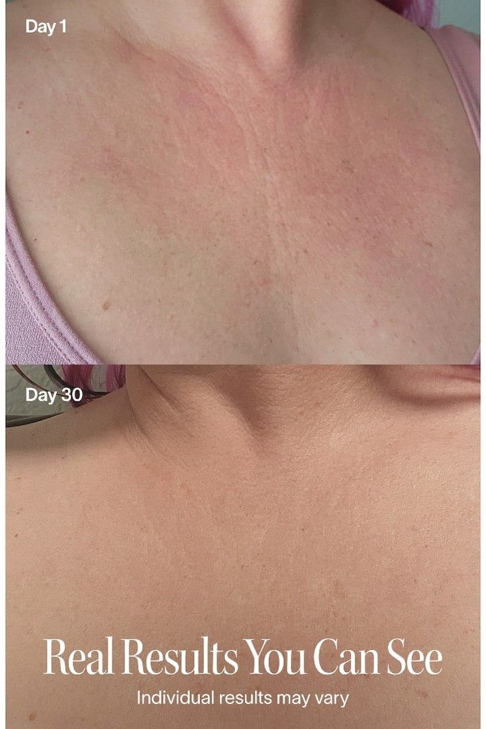 Solawave Red Light Therapy Cihazı