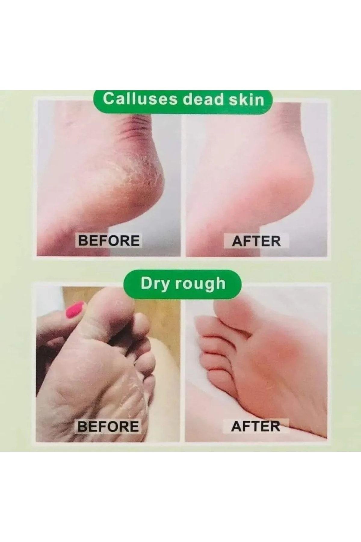 Miracle Foot Peeling Pack – Çorap Tipi Ayak Peeling Maskesi Aloe Vera X 3 Adet