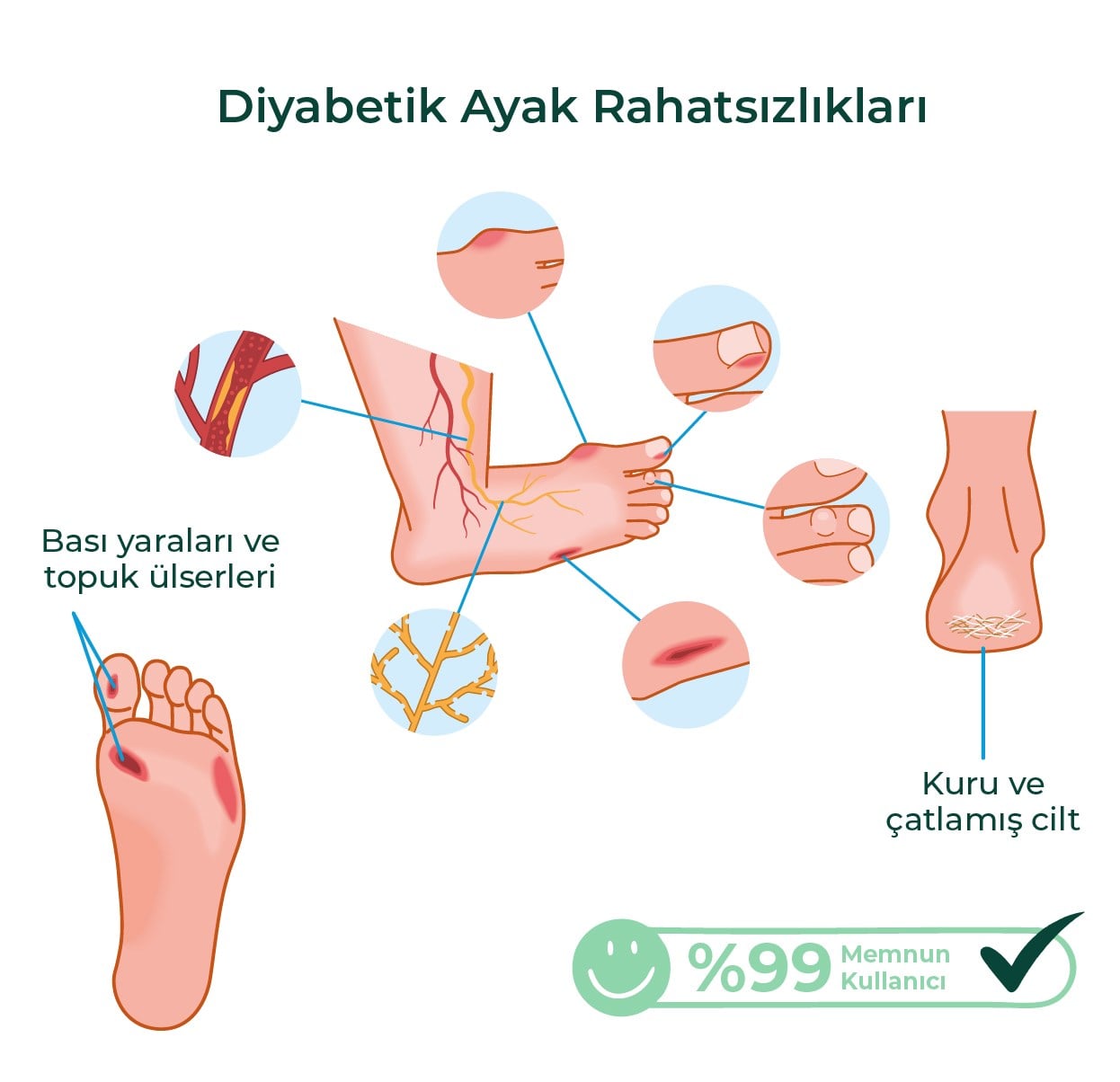 MED-COVER Ayak Bakım Kremi x 2 adet– Uyumlu & Hassas Ciltlere Özel (%10 Üre, Shea Butter, Beeswax