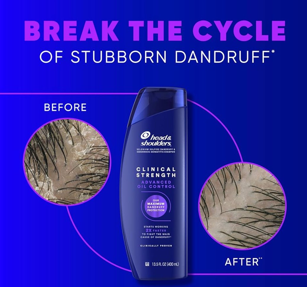 Head Shoulders Clinical Kepek Savunma ve Yağ Kontrol Şampuanı 400 ml