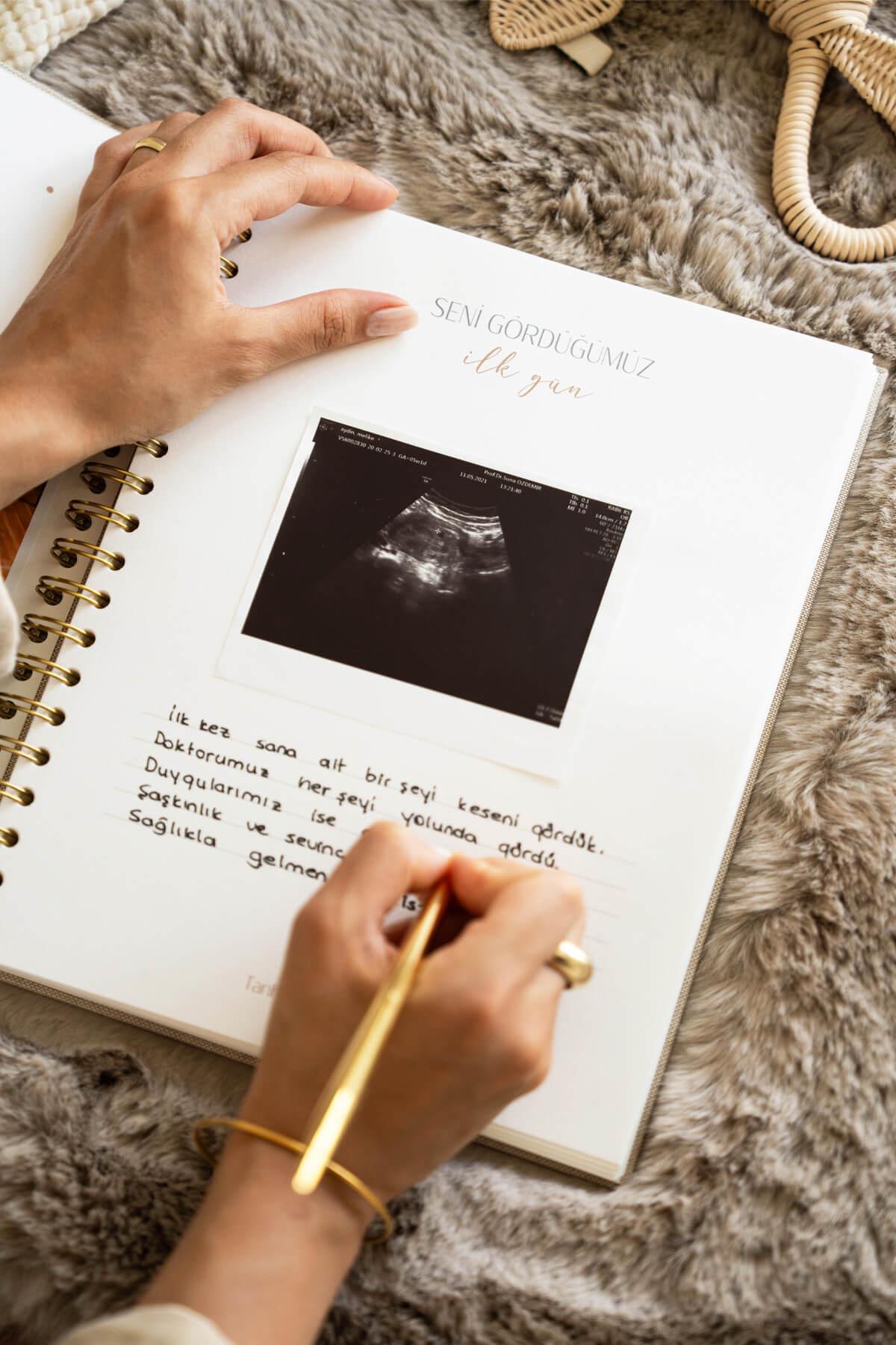 Matt Notebook Bebek Anı Defteri ve Anne Hamile Günlüğü Fotoğraf Albümü
