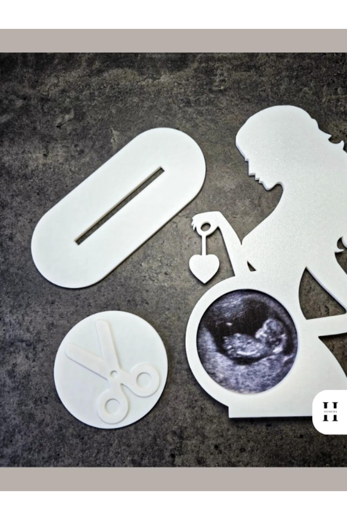 Hamile Anne Ultrason Fotoğraf Çerçevesi – PLA 3D Baskı – Yenidoğan Hatırası