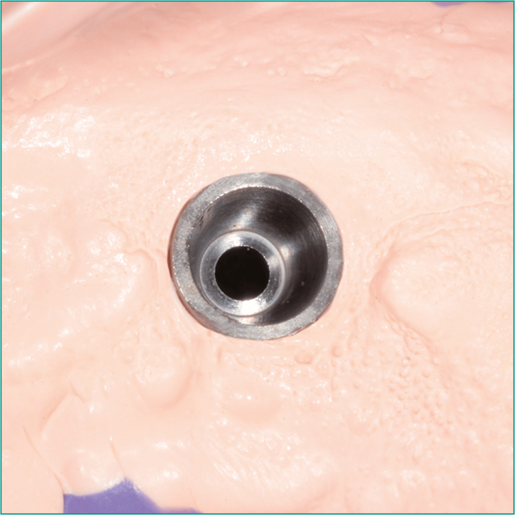 ZHERMACK HYDRORISE IMPLANT LIGHT BODY NORMAL A Silikon