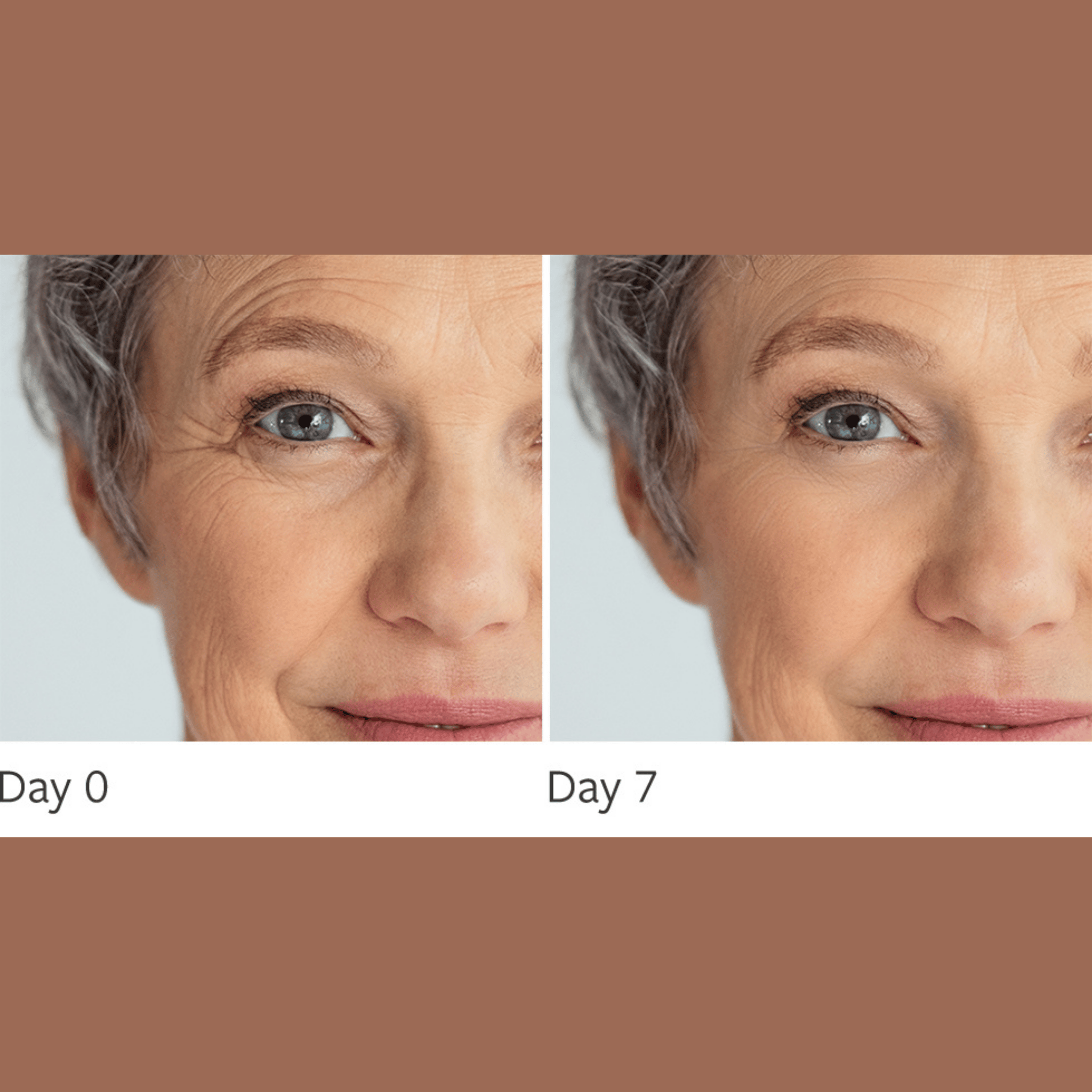 BOOST SERUM