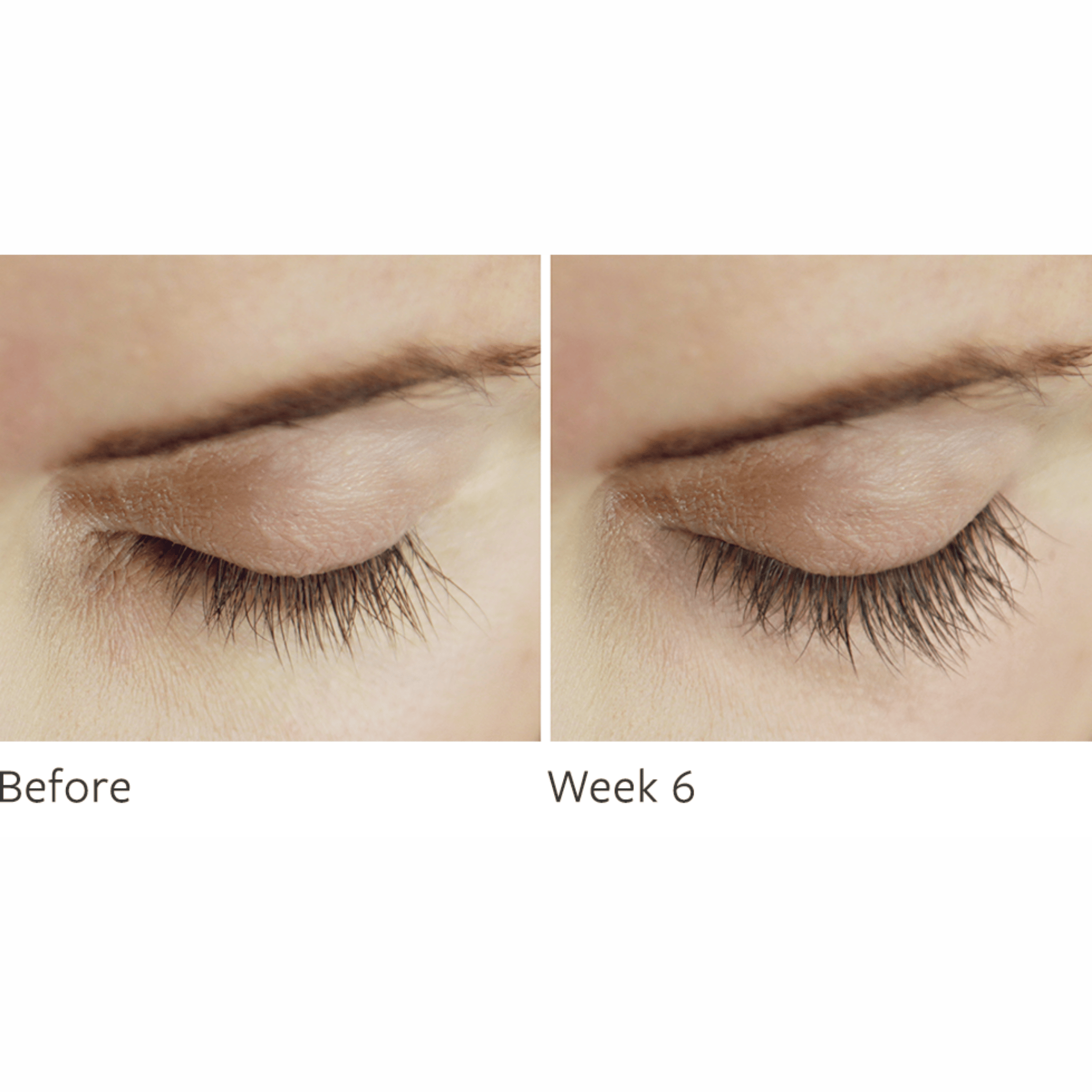 LASH PRESCRIPTION
