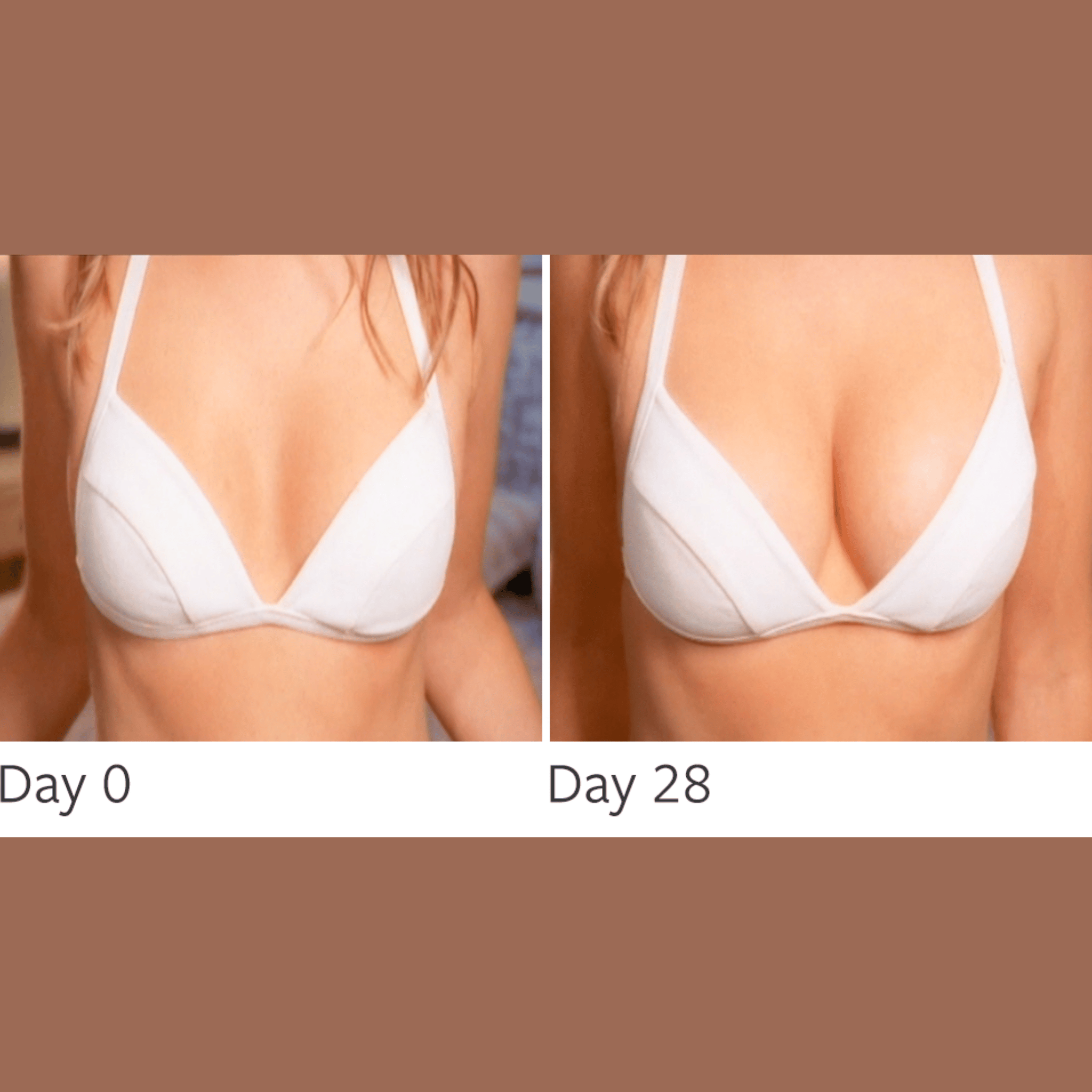 non-surgical BREAST ENHANCER