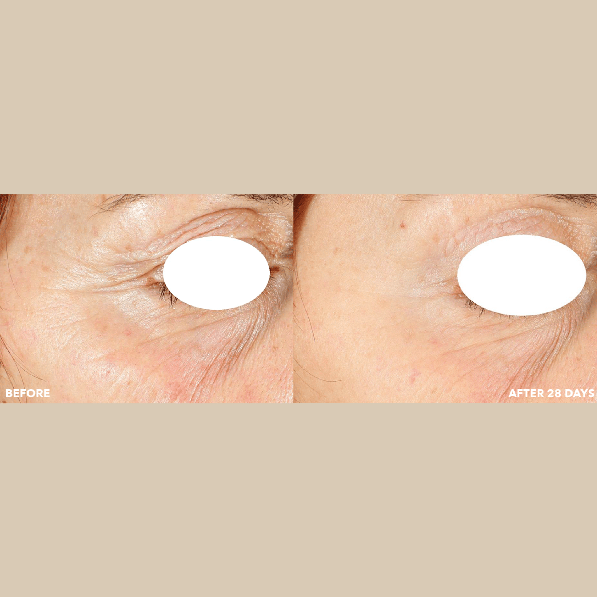 PRO COLLAGEN SUNCEUTICAL