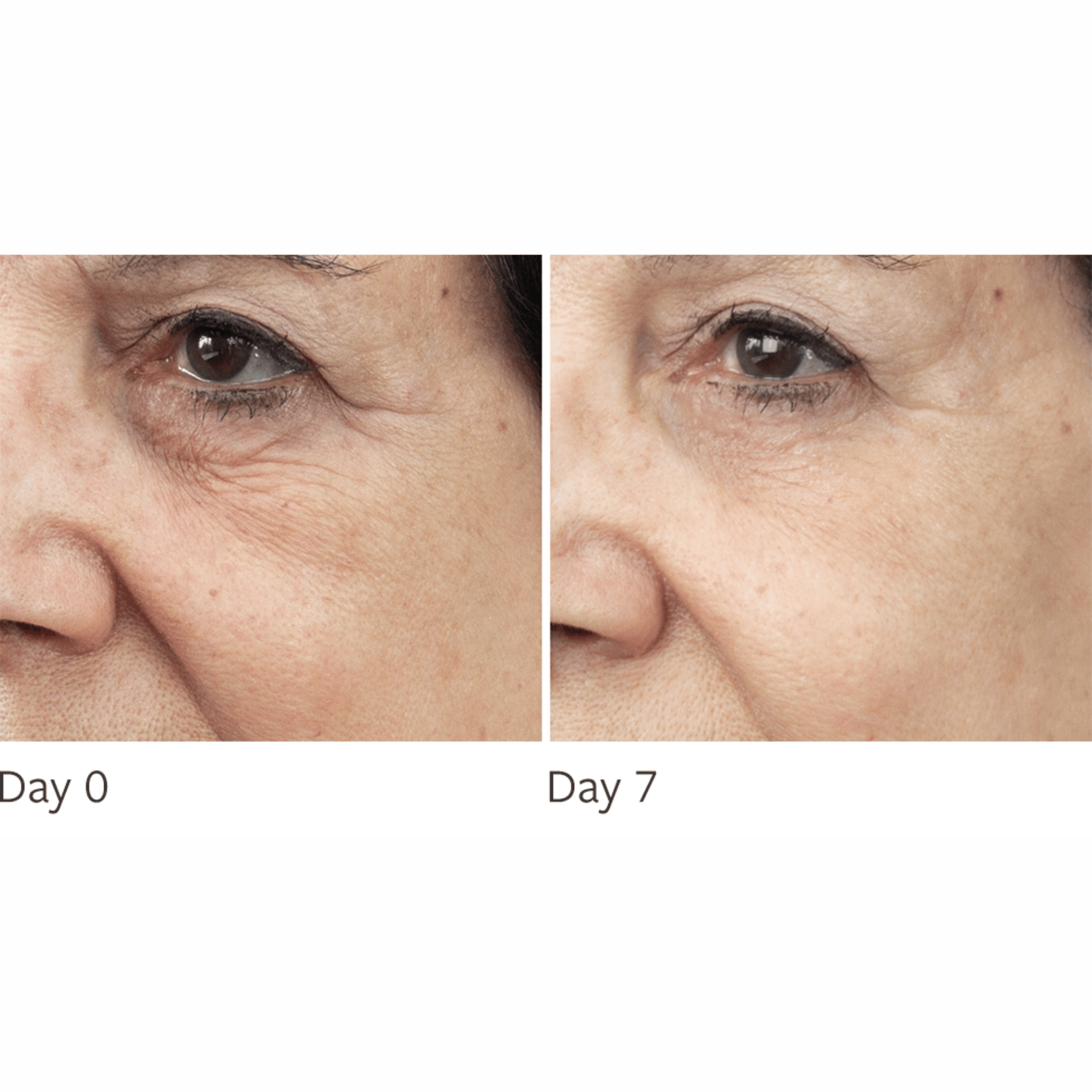 REVITALEYES