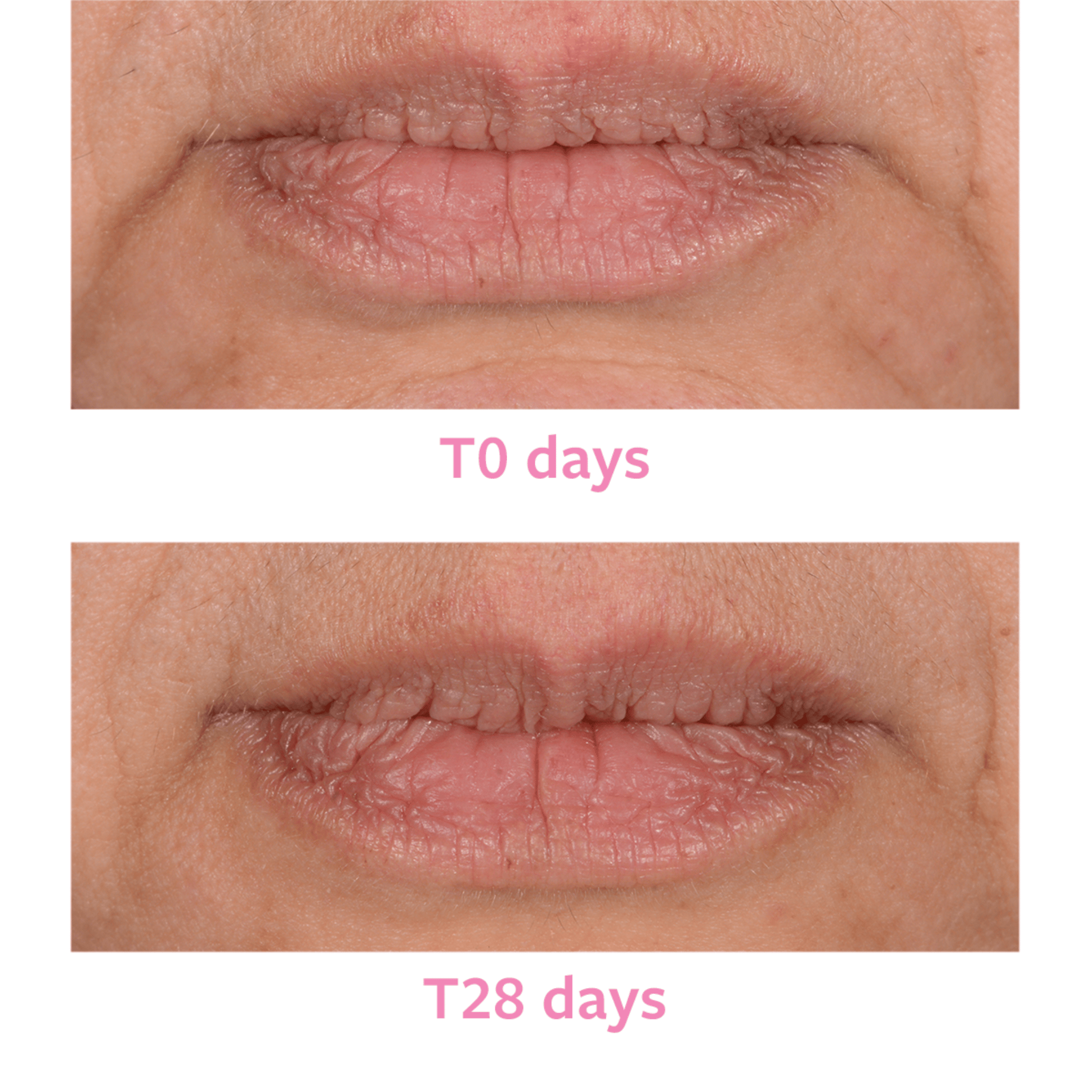WRINKLE BLOCK