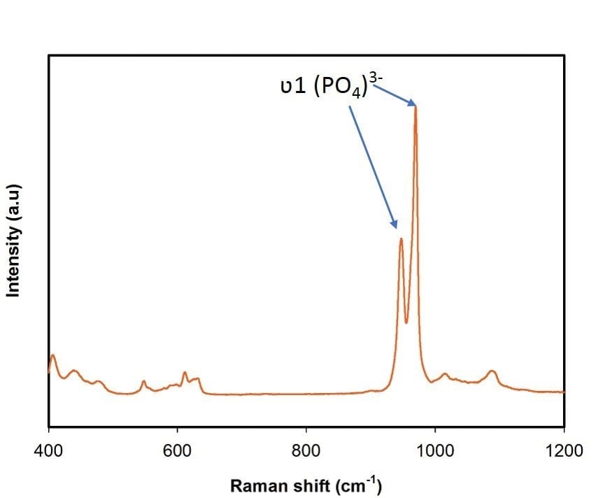 Beta Tricalcium Phosphate (β-TCP, nanopowder)