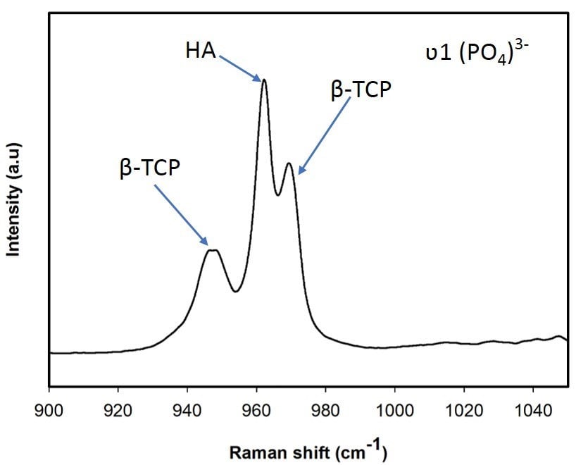 Biphasic calcium phosphate (nanoparticles dispersion, Mixture of HA and β-TCP)