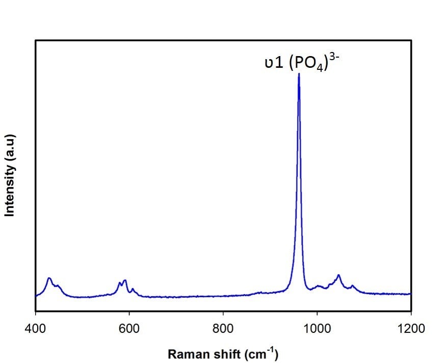 Hydroxyapatite (nanoparticles dispersion)