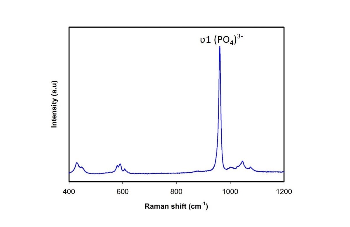 Hydroxyapatite (nanopowder)