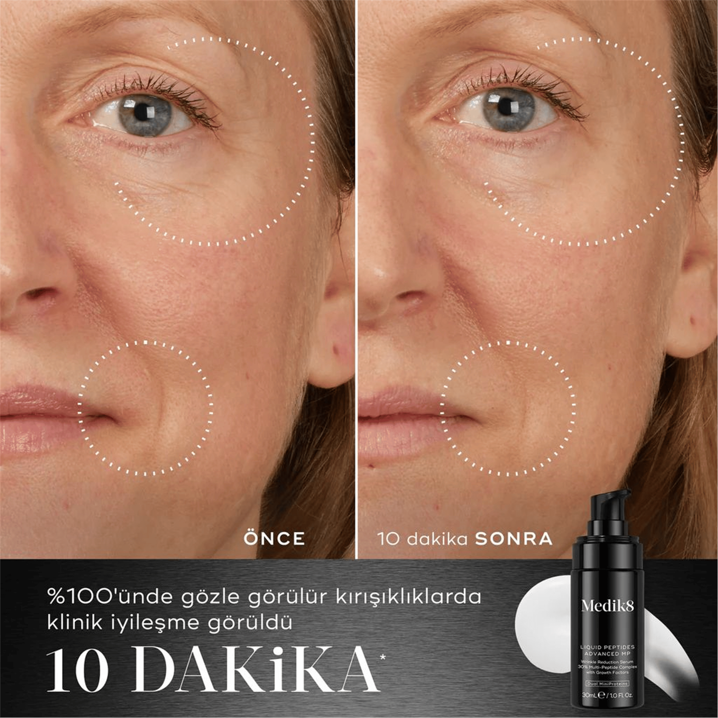 Medik8 Liquıd Peptide Advanced Mp Serum 30Ml P11494